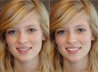 Glamsmile Porselein